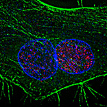 microscopi image of human papillomavirus